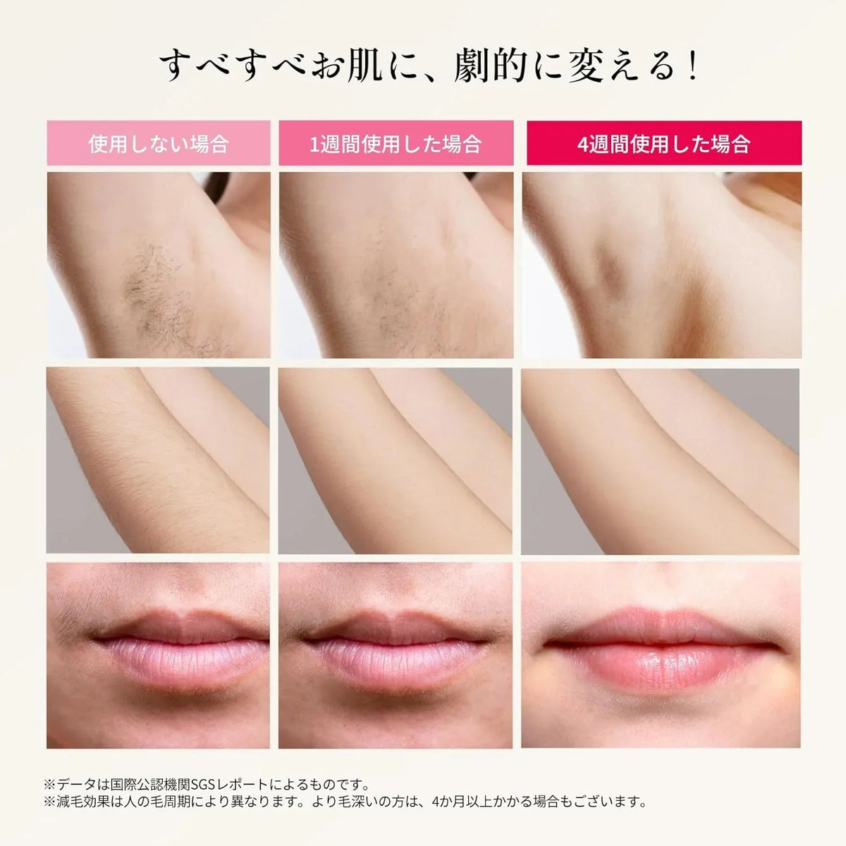 Ulike Air Pro 脱毛器｜家庭用 光美容器 メンズ・レディース全身対応 
